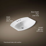 Cimarron® 22-3/4" rectangle drop-in bathroom sink