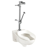 Ultima Manual Flush Valve With Bedpan Washer Assembly, Straight Tube, 1.28 gpf/4.8 Lpf