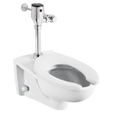 Ultima® Selectronic® Exposed Toilet Flush Valve, Diaphragm Type, Base Model, 1.6 gpf/6.0 Lpf