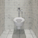 Ultima® Selectronic® Exposed Toilet Flush Valve, Diaphragm Type, Base Model, 1.1 gpf/4.2 Lpf